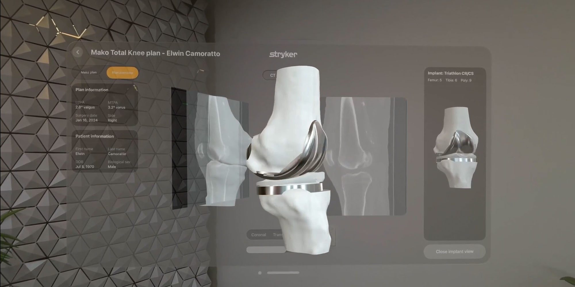Vision Pro is a niche product, but an incredibly valuable one where it counts | Image shows a Vision Pro display being used to assist knee surgery